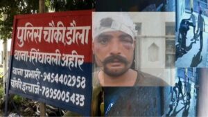 Baghpat Domestic Violence: पत्नी के आशिक को टोका तो ससुराल वालों ने दामाद को बना डाला पंचिंग बैग