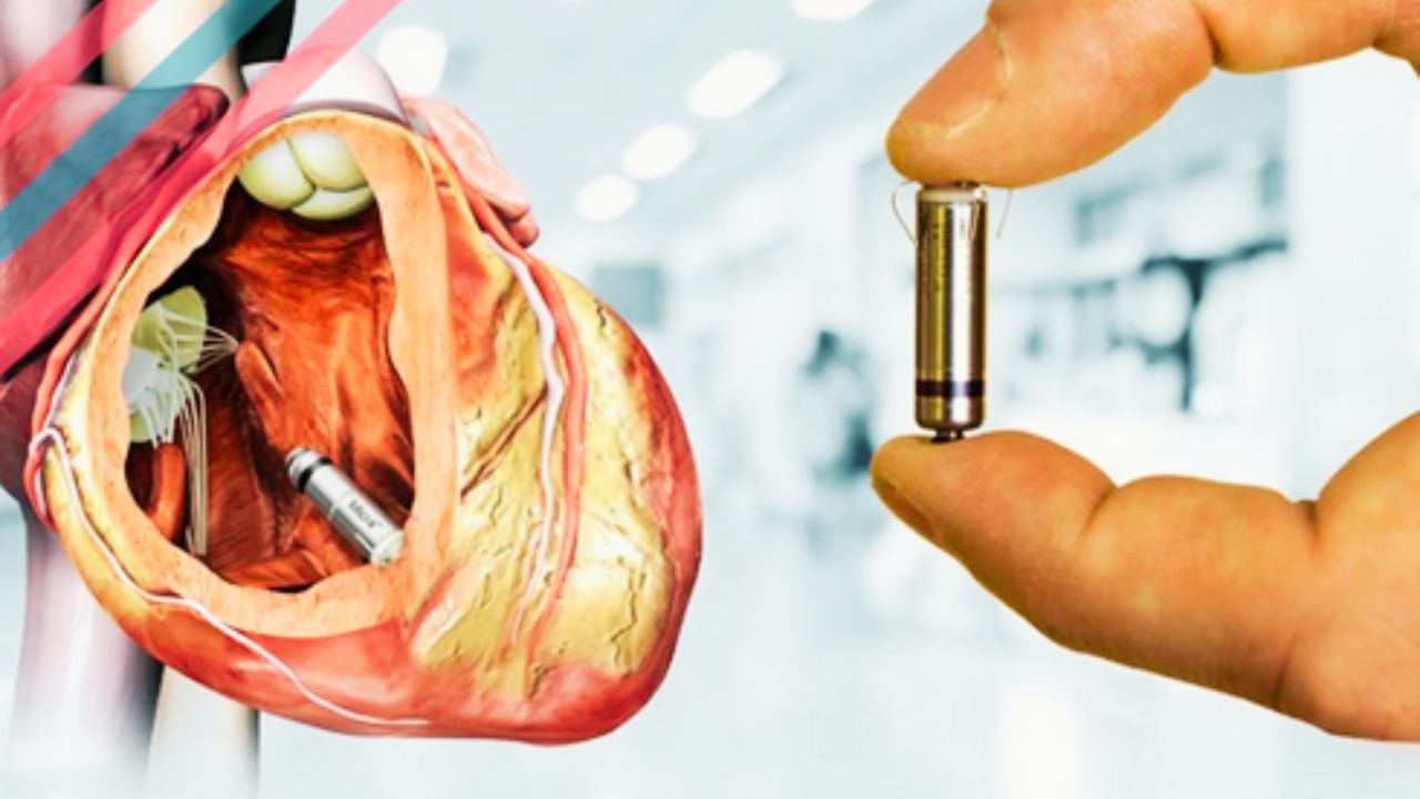 बरेली में रचा इतिहास - 25 मिनट में बदली जिंदगी, मिशन हॉस्पिटल की बड़ी कामयाबी - प्रतीकात्मक तस्वीर