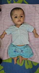 Bulandshahr News: बच्चे के इलाज के लिए चाहिए 17 करोड़ रुपए