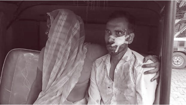 Drunken Wife Attack Husband.