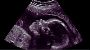 Haryana Sex Determination Gang.