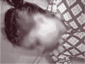 Social Media Influencer Suicide.