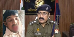 Kanpur Girl Bite Tongue