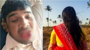 Kanpur Girl Bite Tongue